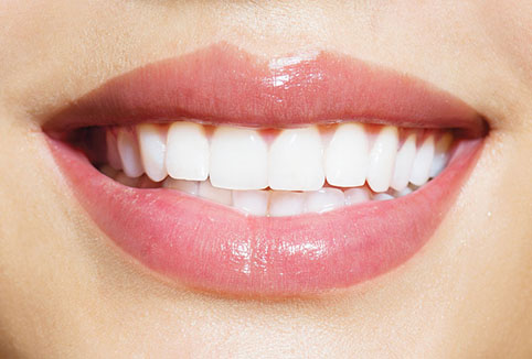 Woman Teeth Before and After Whitening. Over white background. H