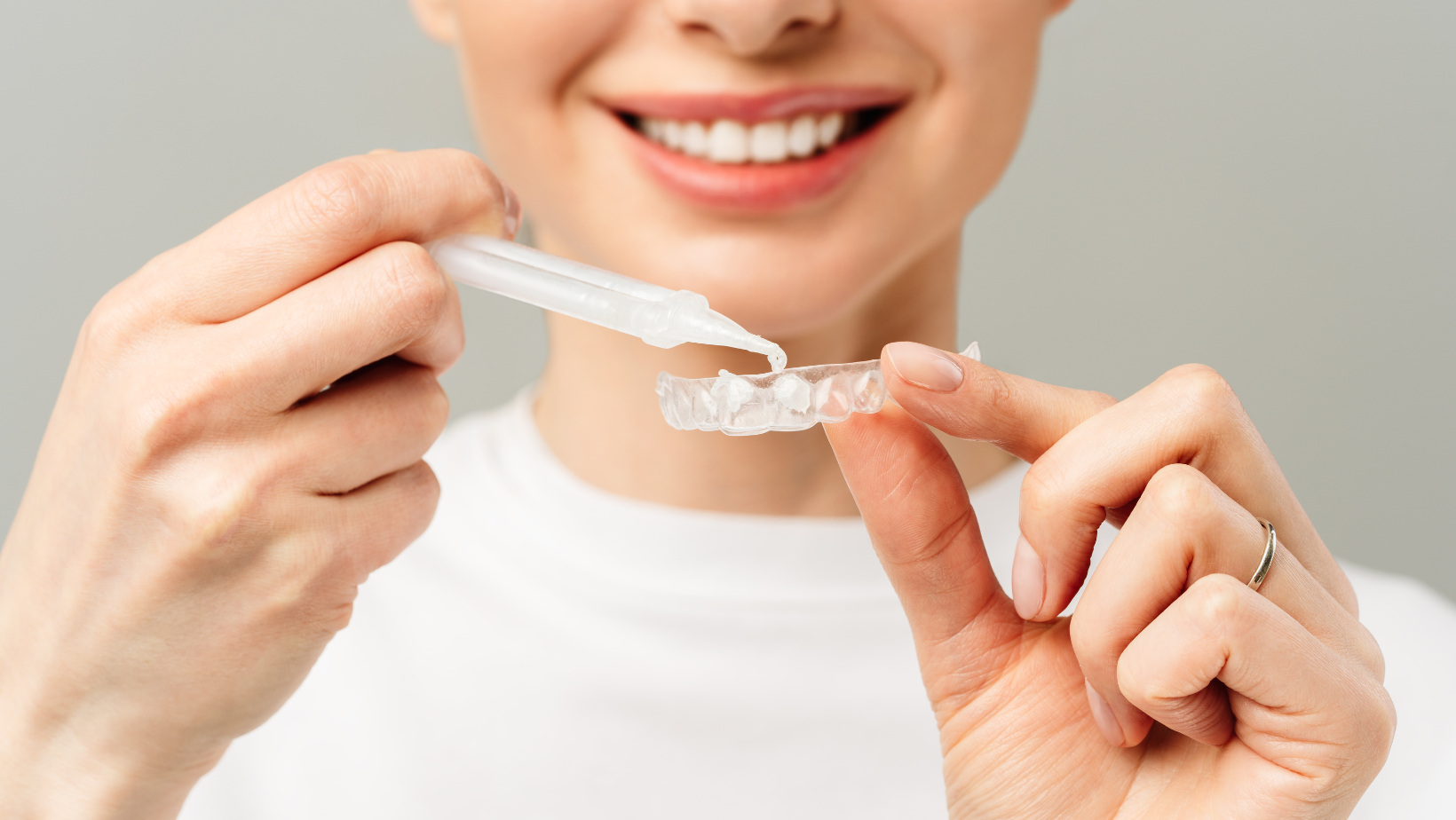 teeth whitening options , Comparing teeth whitening Treatments